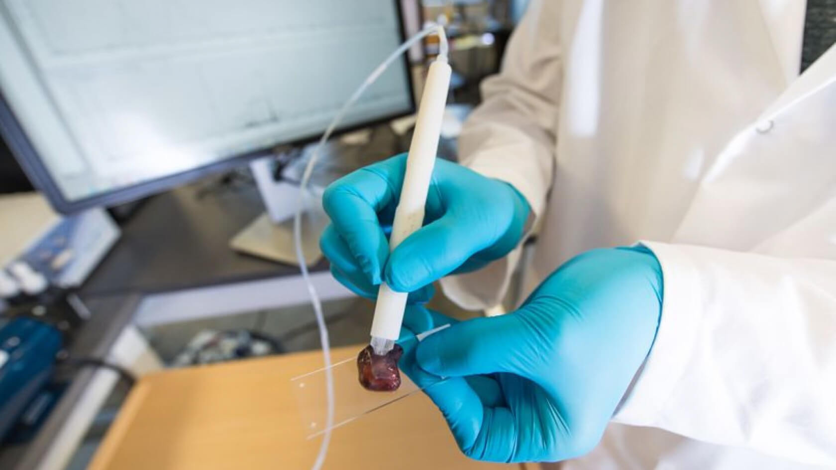 Revolutionary pen device can identify cancer in seconds