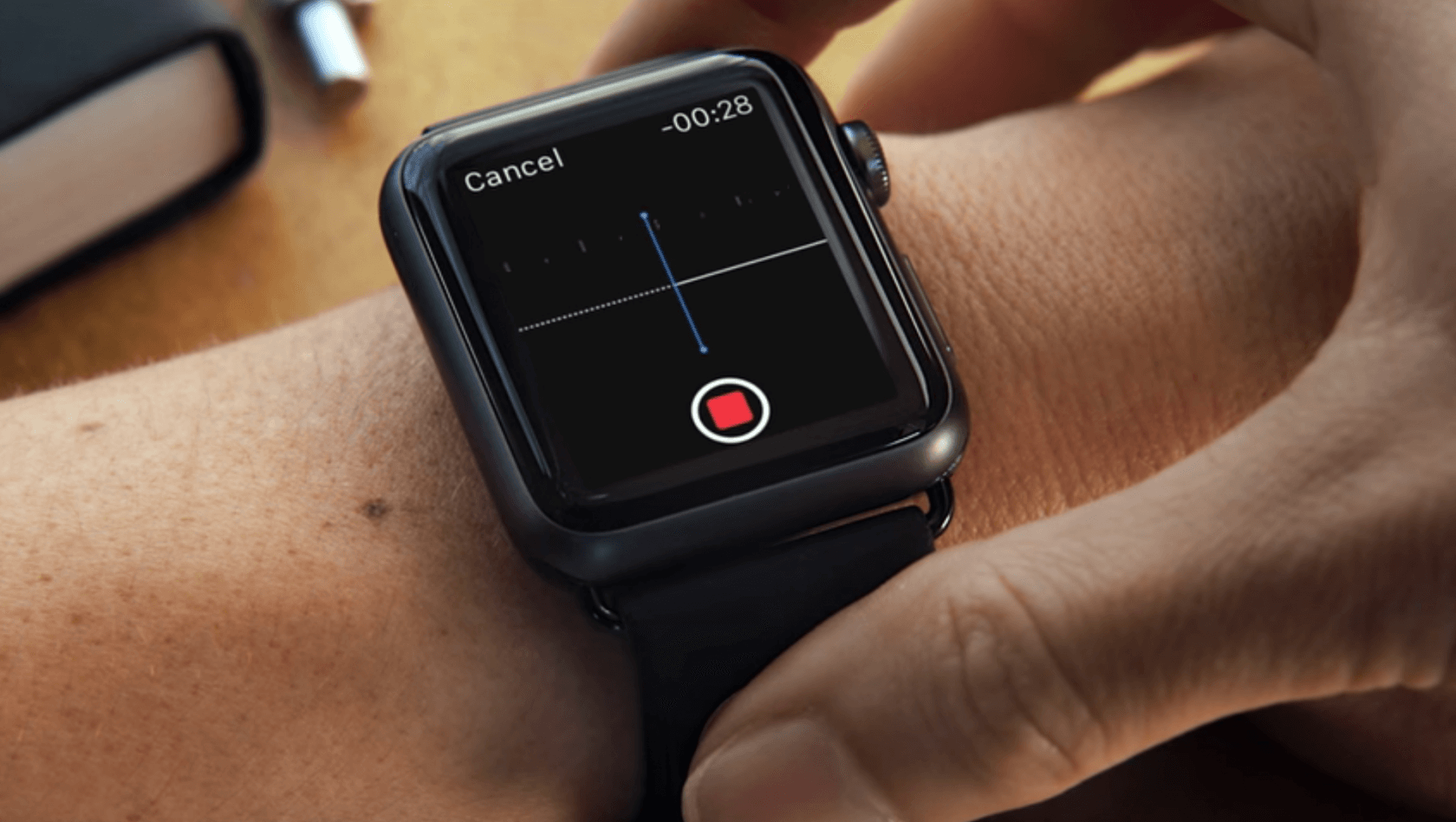 Apple Watch KardiaBand can detect high potassium levels without a needle