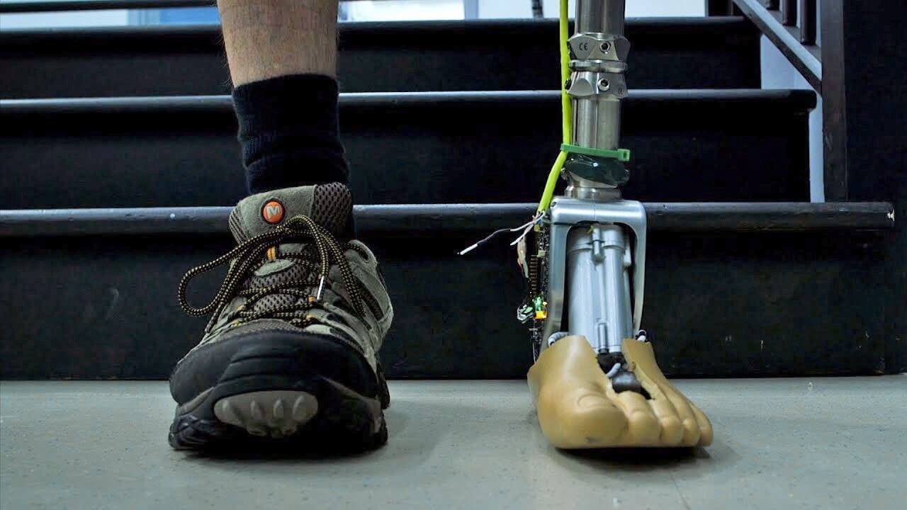 Smart prosthetic ankle lets users take on rough terrain and stairs with ease