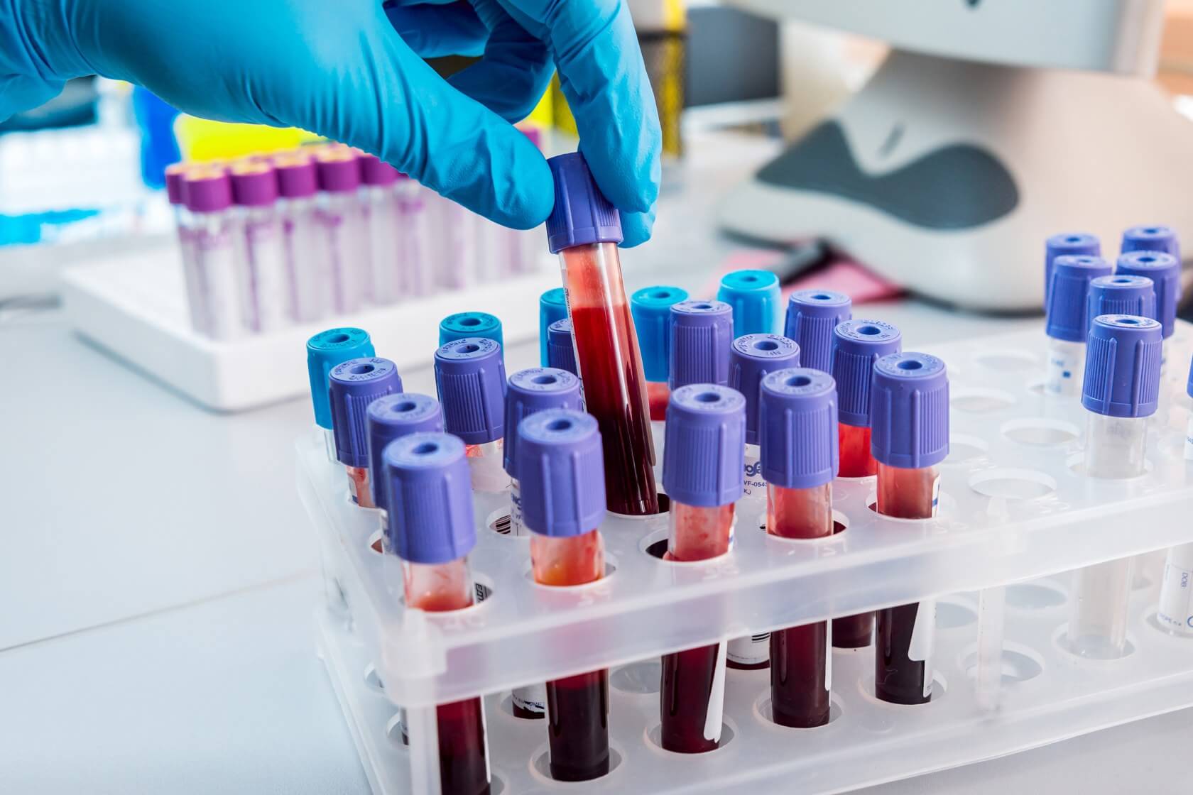 Scientists develop a 'Liquid Health Check' that assesses multiple health factors with one blood test