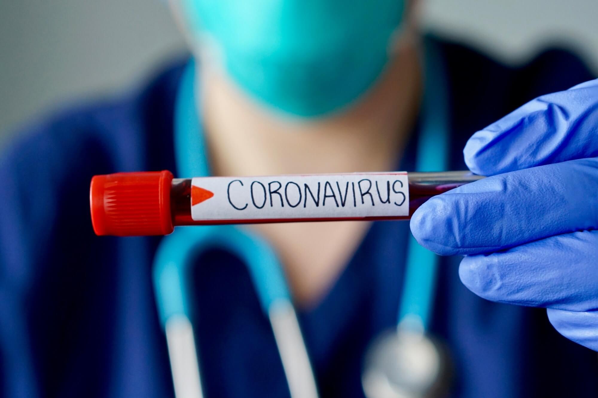 Alibaba develops AI that can identify coronavirus infections with 96% accuracy