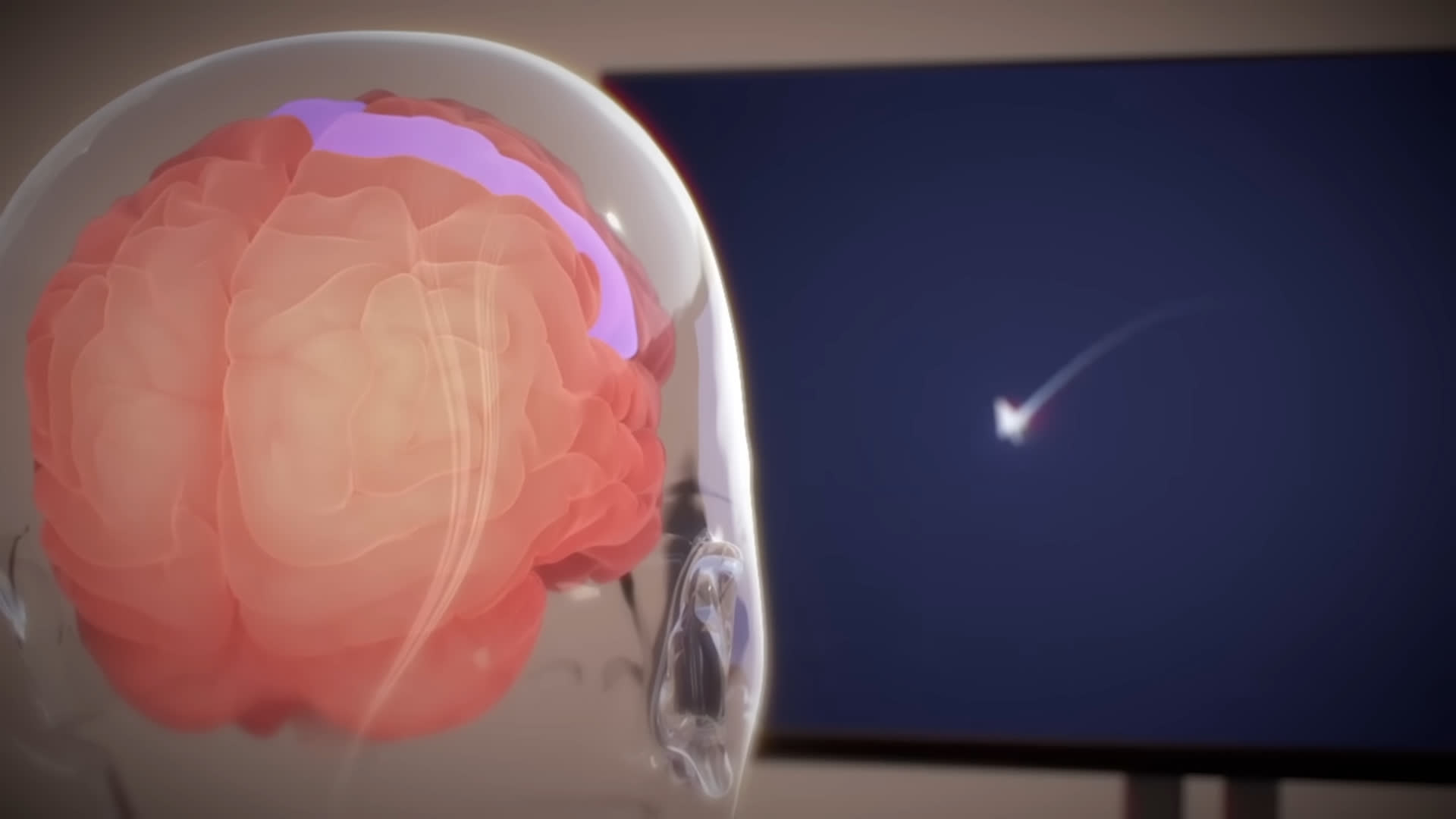 Neuralink's first human subject successfully controls computer mouse with thoughts following brain-chip implant