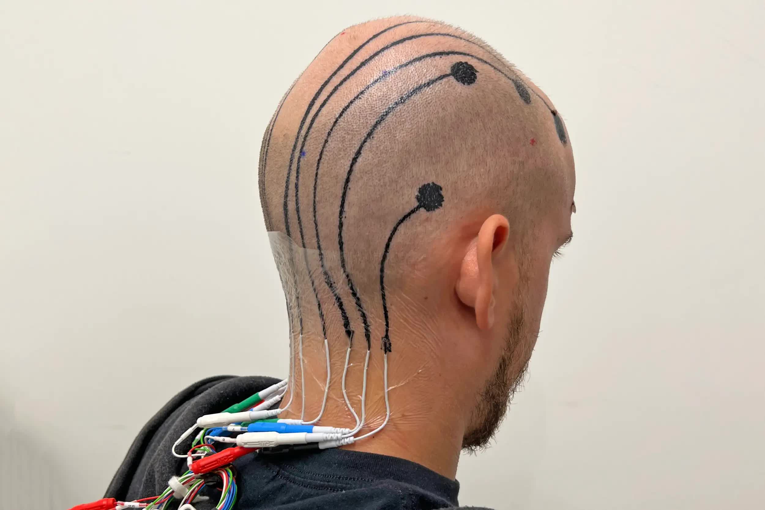 Researchers use e-tattoos on scalps to monitor brain activity