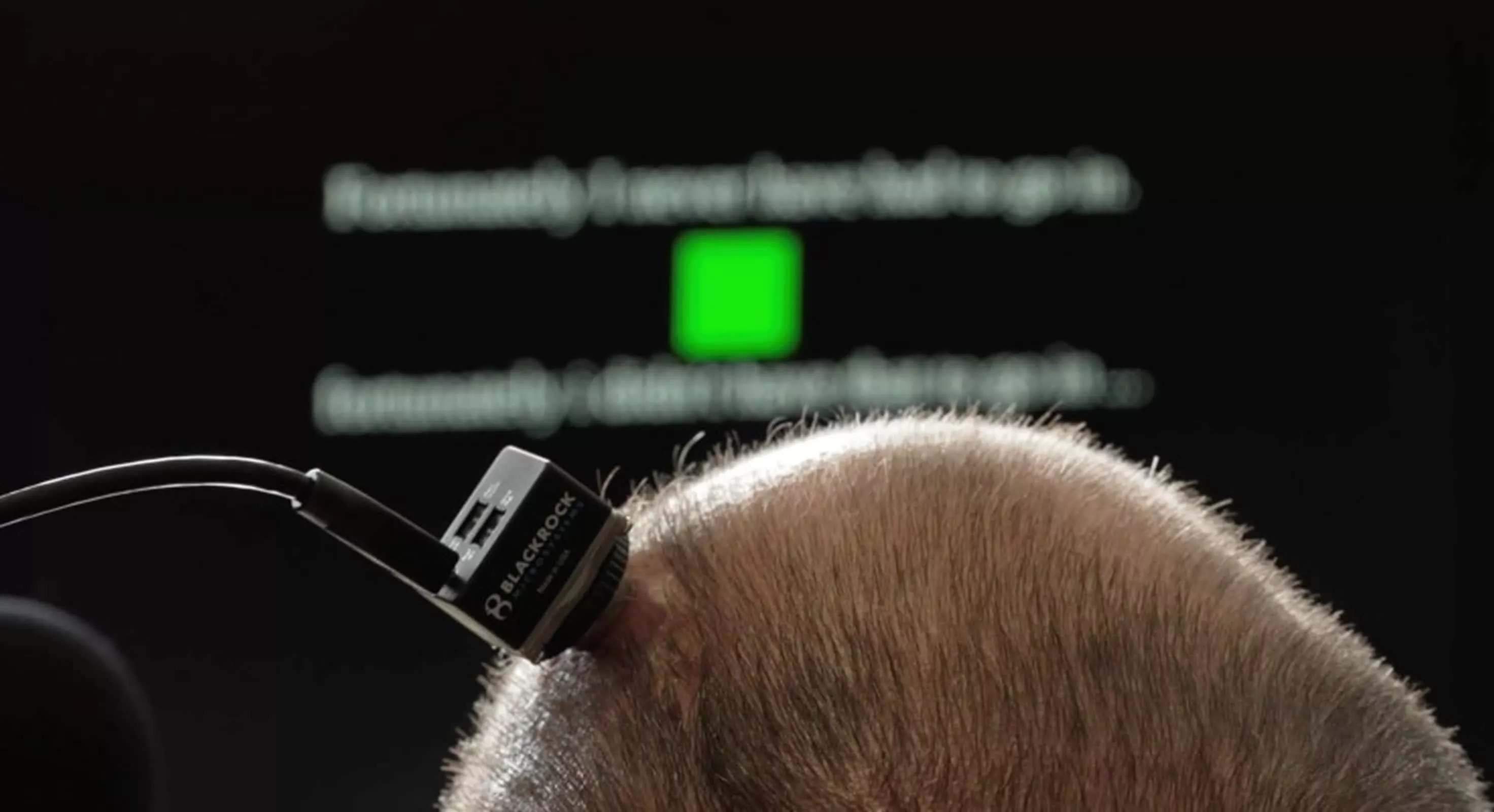 Brain implant at UC Davis translates thoughts into spoken words with emotion - TechSpot