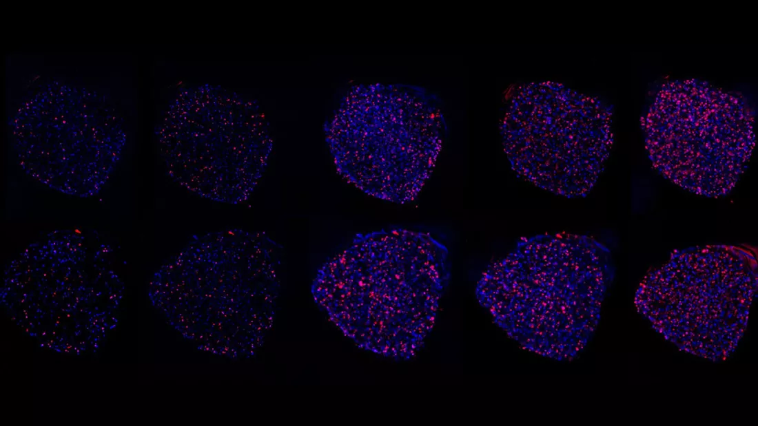 Ocho imágenes microscópicas de esferas celulares teñidas con colores fluorescentes azul y rojo, sobre fondo negro. Representan muestras biológicas observadas posiblemente para análisis de actividad celular o expresión genética.