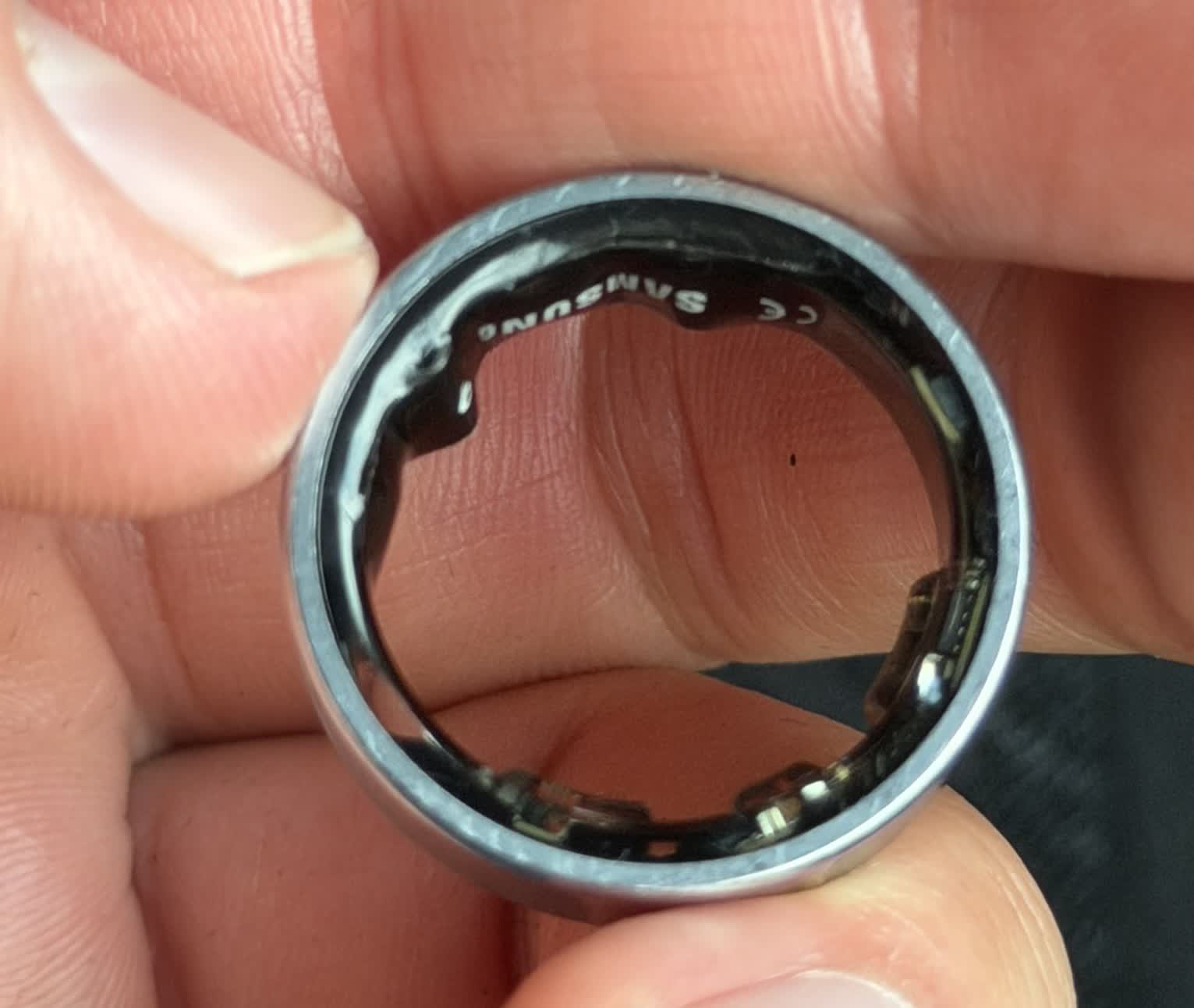 Samsung Galaxy Ring swells and crushes user's finger, causing missed flight and hospital visit Samsung Galaxy Ring swells and crushes user's finger, causing missed flight and hospital visit