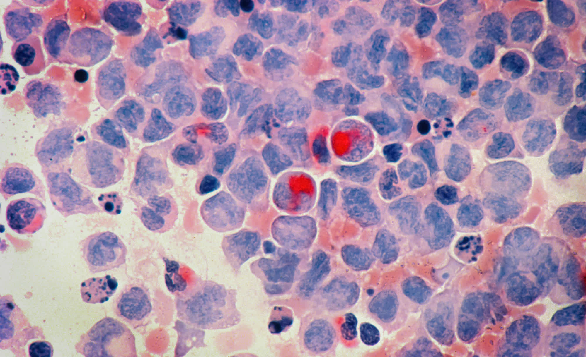 Google and Yale's new AI just made a major cancer discovery - TechSpot