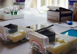 researchers hiv smartphone phone hiv test dongle syphilis smartphone dongle std