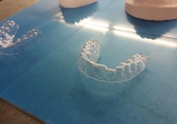 college invisalign 3d printing plastic 3d printer teeth braces 3d printed braces