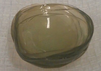 woman contact lens surgery