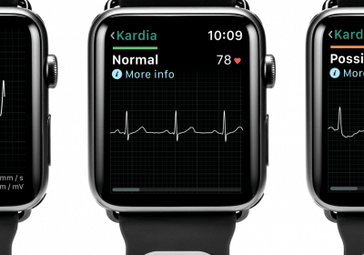apple watch fda EKG kardiaband