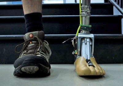 prosthetic