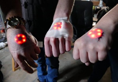 tesla model implant with video