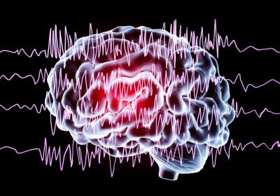 israeli epilepsy medical brain waves