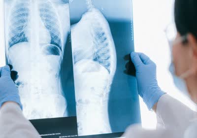 x-rays healthcare doctors