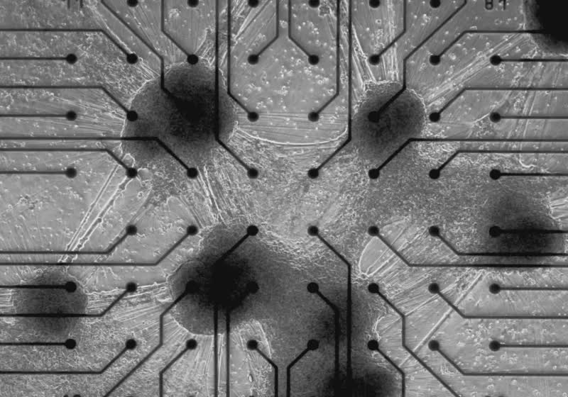 World's first commercial biological computer is here, powered by human brain cells