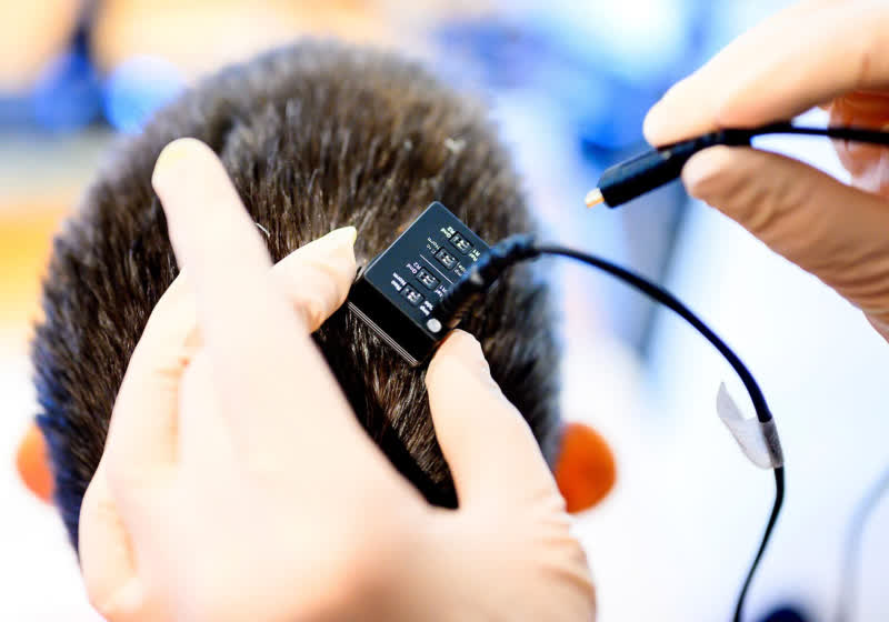 Breakthrough brain-to-voice tech brings natural speech within reach for paralyzed patients