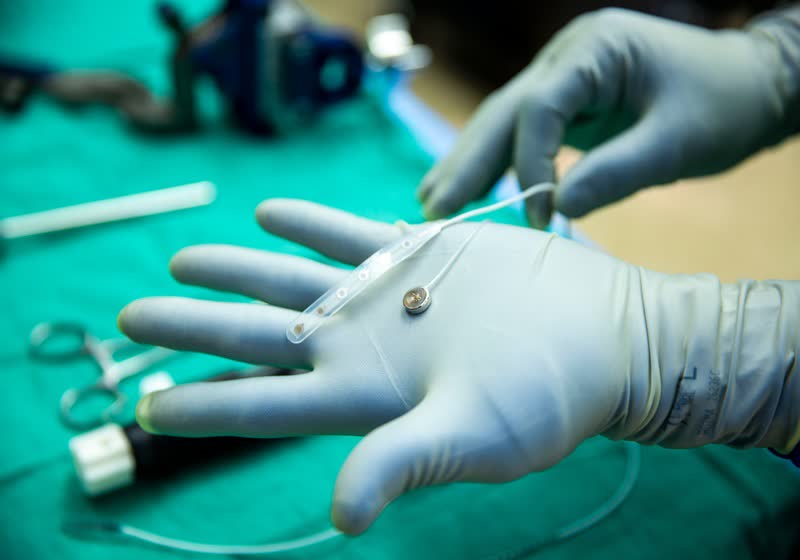 University of Michigan achieves first human brain recording with wireless implant