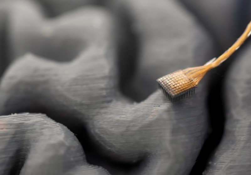 Brain implant at UC Davis translates thoughts into spoken words with ...