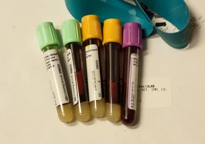 scientists blood