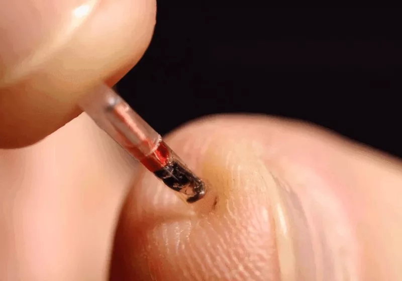 Washington state bill would ban employers from forcibly microchipping workers