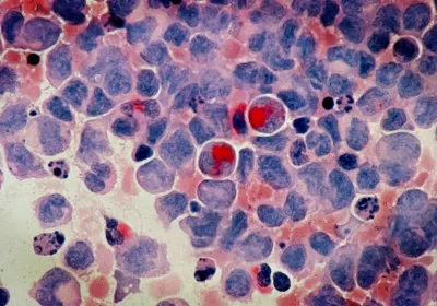 scientists cancer healthcare biotech oregon state university