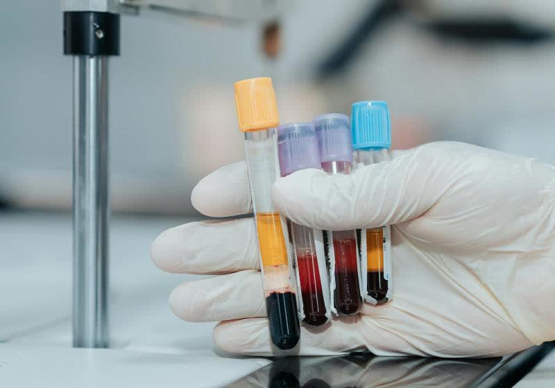 An AI-developed drug appeared to make patients biologically younger in a clinical trial