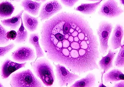 researchers cancer healthcare bioengineering immunotherapy